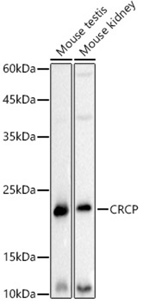 Western blot analysis of extracts of various cell lines, using CRCP antibody (CAB21151) at1:500 dilution. Secondary antibody: HRP Goat Anti-Rabbit IgG (H+L) at 1:10000 dilution. Lysates/proteins: 25μg per lane. Blocking buffer: 3% nonfat dry milk in TBST.