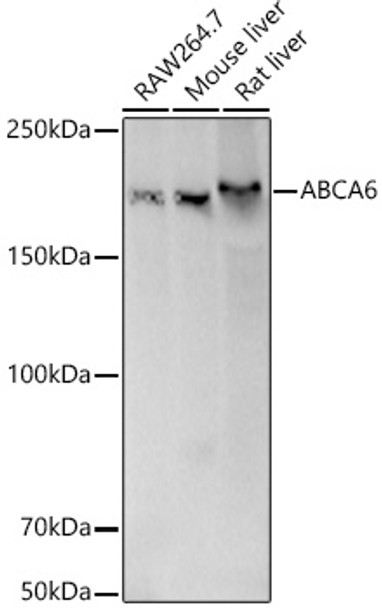 Western blot analysis of extracts of various cell lines, using ABCA6 antibody (CAB21243) at 1:1000 dilution. Secondary antibody: HRP Goat Anti-Rabbit IgG (H+L) at 1:10000 dilution. Lysates/proteins: 25μg per lane. Blocking buffer: 3% nonfat dry milk in TBST.