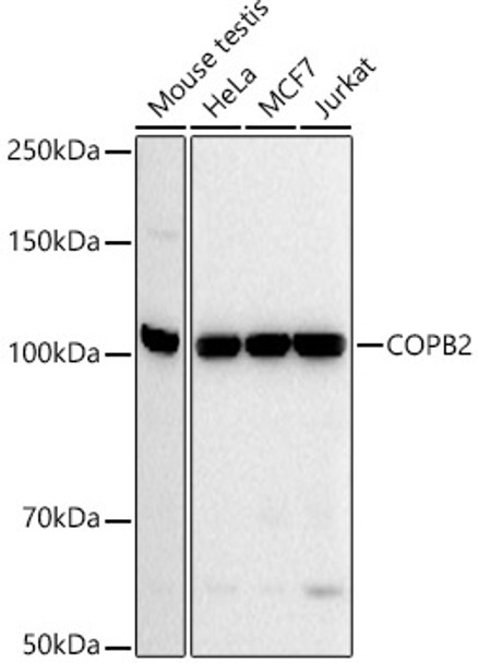 Western blot analysis of extracts of various cell lines, using COPB2 antibody (CAB21294) at 1:20000 dilution. Secondary antibody: HRP Goat Anti-Rabbit IgG (H+L) at 1:10000 dilution. Lysates/proteins: 25μg per lane. Blocking buffer: 3% nonfat dry milk in TBST.