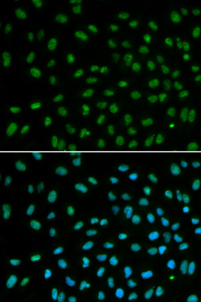 Immunofluorescence analysis of MCF-7 cells using DDB2 antibody (CAB21374). Blue: DAPI for nuclear staining.
