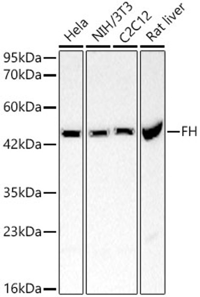 Western blot analysis of various lysates, using FH Rabbit pAb (CAB21403) at 1:1000 dilution. Secondary antibody: HRP Goat Anti-Rabbit IgG (H+L) at 1:10000 dilution. Lysates/proteins: 25μg per lane. Blocking buffer: 3% nonfat dry milk in TBST.