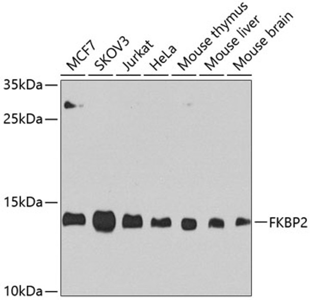Western blot analysis of extracts of various cell lines, using FKBP2 antibody (CAB21404) at 1:1000 dilution. Secondary antibody: HRP Goat Anti-Rabbit IgG (H+L) at 1:10000 dilution. Lysates/proteins: 25μg per lane. Blocking buffer: 3% nonfat dry milk in TBST.