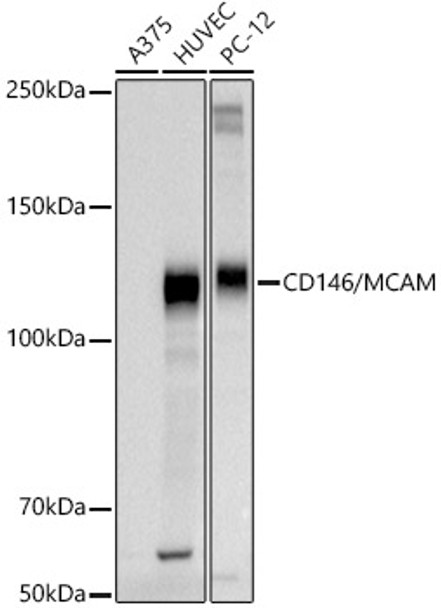 Western blot analysis of extracts of various cell lines, using CD146/MCAM antibody (CAB21488) at 1:1000 dilution. Secondary antibody: HRP Goat Anti-Rabbit IgG (H+L) at 1:10000 dilution. Lysates/proteins: 25μg per lane. Blocking buffer: 3% nonfat dry milk in TBST.