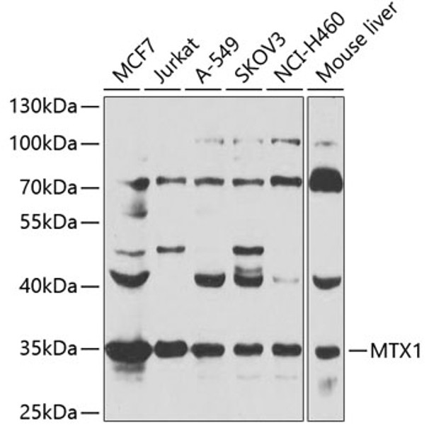 Western blot analysis of extracts of various cell lines, using MTX1 antibody (CAB21498) at 1:1000 dilution. _Secondary antibody: HRP Goat Anti-Rabbit IgG (H+L) at 1:10000 dilution. _Lysates/proteins: 25μg per lane. _Blocking buffer: 3% nonfat dry milk in TBST. _
