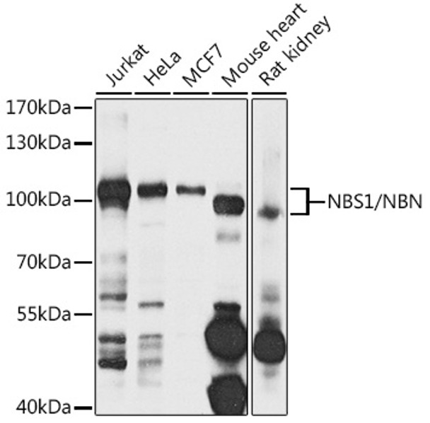 Western blot analysis of extracts of various cell lines, using NBS1/NBS1/NBN antibody (CAB21501) at 1:1000 dilution. Secondary antibody: HRP Goat Anti-Rabbit IgG (H+L) at 1:10000 dilution. Lysates/proteins: 25μg per lane. Blocking buffer: 3% nonfat dry milk in TBST.