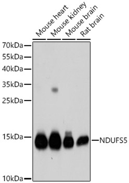 Western blot analysis of various lysates, using NDUFS5 Rabbit pAb (CAB21504) at 1:1000 dilution. Secondary antibody: HRP Goat Anti-Rabbit IgG (H+L) at 1:10000 dilution. Lysates/proteins: 25ug per lane. Blocking buffer: 3% nonfat dry milk in TBST.