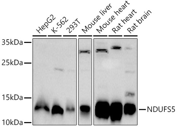 Western blot analysis of extracts of various cell lines, using NDUFS5 antibody (CAB21505) at 1:1000 dilution. Secondary antibody: HRP Goat Anti-Rabbit IgG (H+L) at 1:10000 dilution. Lysates/proteins: 25μg per lane. Blocking buffer: 3% nonfat dry milk in TBST.