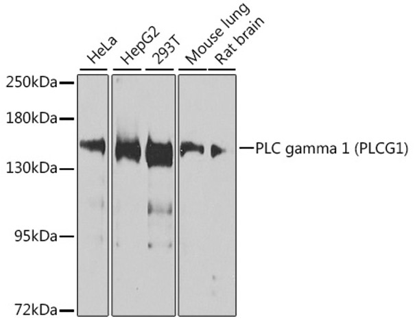 Western blot analysis of extracts of various cell lines, using PLC gamma 1 (PLC gamma 1 (PLCG1)) antibody (CAB21545) at 1:1000 dilution. Secondary antibody: HRP Goat Anti-Rabbit IgG (H+L) at 1:10000 dilution. Lysates/proteins: 25μg per lane. Blocking buffer: 3% nonfat dry milk in TBST.