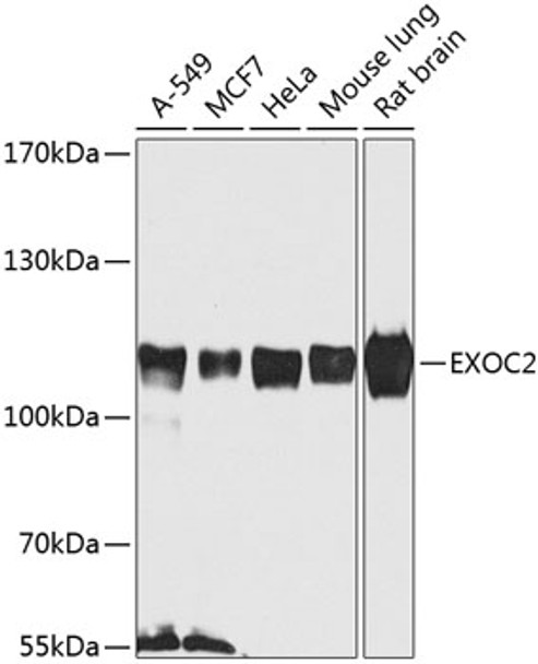 Western blot analysis of extracts of various cell lines, using EXOC2 antibody (CAB21568) at 1:1000 dilution. Secondary antibody: HRP Goat Anti-Rabbit IgG (H+L) at 1:10000 dilution. Lysates/proteins: 25μg per lane. Blocking buffer: 3% nonfat dry milk in TBST.