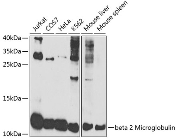 Western blot analysis of extracts of various cell lines, using beta 2 Microglobulin antibody (CAB21573) at 1:1000 dilution. Secondary antibody: HRP Goat Anti-Rabbit IgG (H+L) at 1:10000 dilution. Lysates/proteins: 25μg per lane. Blocking buffer: 3% nonfat dry milk in TBST.
