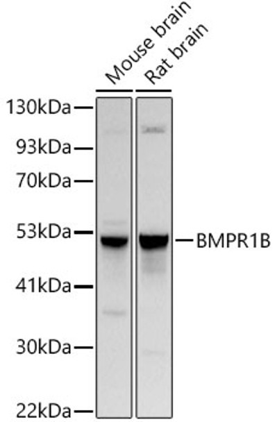 Western blot analysis of various lysates, using BMPR1B Rabbit pAb (CAB21605) at 1:1000 dilution. Secondary antibody: HRP Goat Anti-Rabbit IgG (H+L) at 1:10000 dilution. Lysates/proteins: 25μg per lane. Blocking buffer: 3% nonfat dry milk in TBST.