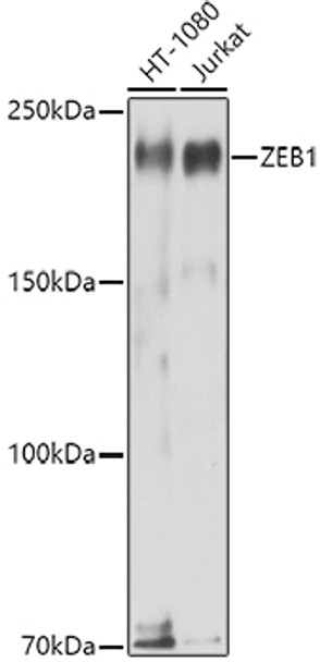 Western blot analysis of extracts of various cell lines, using ZEB1 antibody (CAB21617) at 1:1000 dilution. Secondary antibody: HRP Goat Anti-Rabbit IgG (H+L) at 1:10000 dilution. Lysates/proteins: 25μg per lane. Blocking buffer: 3% nonfat dry milk in TBST.