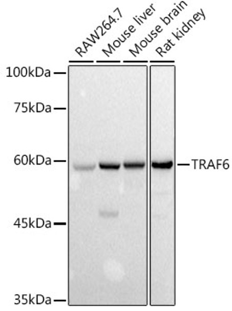 Western blot analysis of extracts of various cell lines, using TRAF6 antibody (CAB21637) at 1:1000 dilution. Secondary antibody: HRP Goat Anti-Rabbit IgG (H+L) at 1:10000 dilution. Lysates/proteins: 25μg per lane. Blocking buffer: 3% nonfat dry milk in TBST.