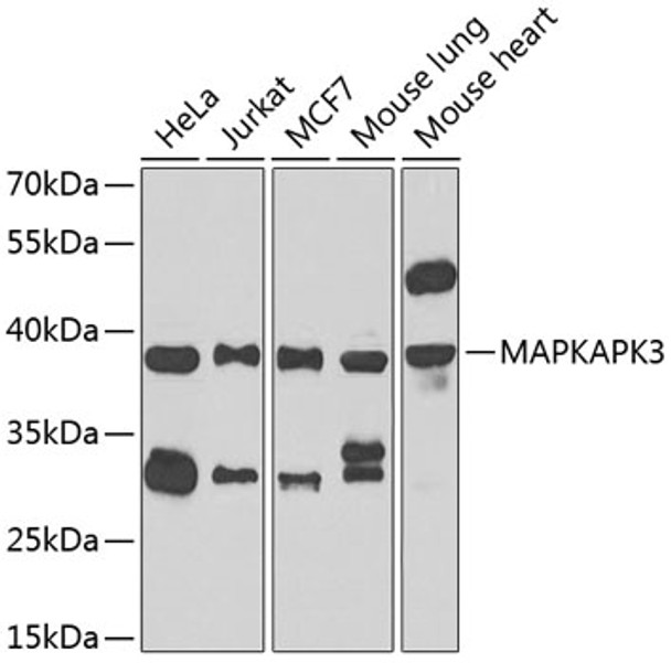 Western blot analysis of extracts of various cell lines, using MAPKAPK3 antibody (CAB21655) at 1:1000 dilution. Secondary antibody: HRP Goat Anti-Rabbit IgG (H+L) at 1:10000 dilution. Lysates/proteins: 25μg per lane. Blocking buffer: 3% nonfat dry milk in TBST.
