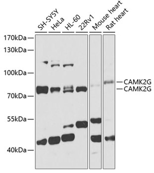 Western blot analysis of extracts of various cell lines, using CAMK2G antibody (CAB21668) at 1:1000 dilution. Secondary antibody: HRP Goat Anti-Rabbit IgG (H+L) at 1:10000 dilution. Lysates/proteins: 25μg per lane. Blocking buffer: 3% nonfat dry milk in TBST.