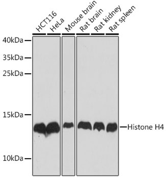 Western blot analysis of extracts of various cell lines, using Histone H4 antibody (CAB21676) at 1:1000 dilution. Secondary antibody: HRP Goat Anti-Rabbit IgG (H+L) at 1:10000 dilution. Lysates/proteins: 25μg per lane. Blocking buffer: 3% nonfat dry milk in TBST.