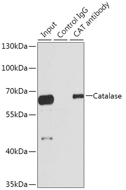 Immunoprecipitation analysis of 100 μg extracts of HepG2 cells using 3 μg Catalasealase antibody (CAB21688). Western blot was performed from the immunoprecipitate using Catalasealase antibody (CAB21688) at a dilution of 1:1000.