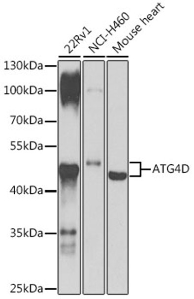 Western blot analysis of extracts of various cell lines, using ATG4D antibody (CAB21690) at 1:1000 dilution. Secondary antibody: HRP Goat Anti-Rabbit IgG (H+L) at 1:10000 dilution. Lysates/proteins: 25μg per lane. Blocking buffer: 3% nonfat dry milk in TBST.