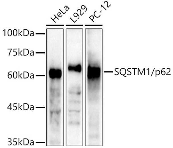 Western blot analysis of extracts of various cell lines, using SQSTM1/p62 antibody (CAB21702) at 1:4000 dilution. Secondary antibody: HRP Goat Anti-Rabbit IgG (H+L) at 1:10000 dilution. Lysates/proteins: 25μg per lane. Blocking buffer: 3% nonfat dry milk in TBST.