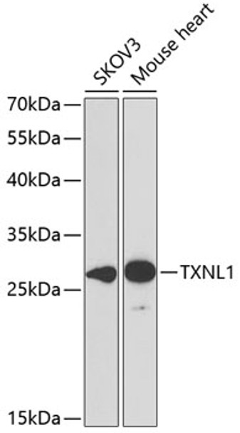 Western blot analysis of extracts of various cell lines, using TXNL1 antibody (CAB21711) at 1:1000 dilution. Secondary antibody: HRP Goat Anti-Rabbit IgG (H+L) at 1:10000 dilution. Lysates/proteins: 25μg per lane. Blocking buffer: 3% nonfat dry milk in TBST.