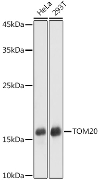 Western blot analysis of extracts of various cell lines, using TOM20 antibody (CAB21723) at 1:1000 dilution. Secondary antibody: HRP Goat Anti-Rabbit IgG (H+L) at 1:10000 dilution. Lysates/proteins: 25μg per lane. Blocking buffer: 3% nonfat dry milk in TBST.