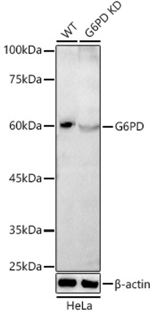 Western blot analysis of extracts from wild type(WT) and G6PD knockdown (KD) HeLa cells, using G6PD antibody (CAB21750) at 1:1000 dilution. Secondary antibody: HRP Goat Anti-Rabbit IgG (H+L) at 1:10000 dilution. Lysates/proteins: 25μg per lane. Blocking buffer: 3% nonfat dry milk in TBST.