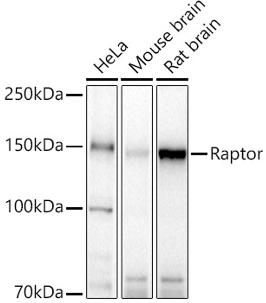 Western blot analysis of various lysates, using Raptor Rabbit pAb (CAB21756) at 1:500 dilution. Secondary antibody: HRP Goat Anti-Rabbit IgG (H+L) at 1:10000 dilution. Lysates/proteins: 25ug per lane. Blocking buffer:3% nonfat dry milk in TBST.