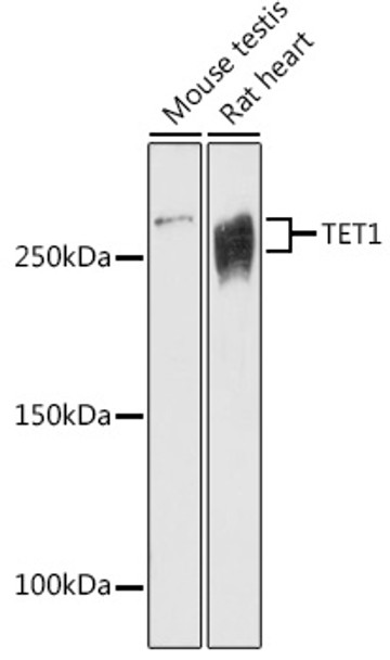 Western blot analysis of extracts of various cell lines, using TET1 antibody (CAB21766) at 1:1000 dilution. Secondary antibody: HRP Goat Anti-Rabbit IgG (H+L) at 1:10000 dilution. Lysates/proteins: 25μg per lane. Blocking buffer: 3% nonfat dry milk in TBST.