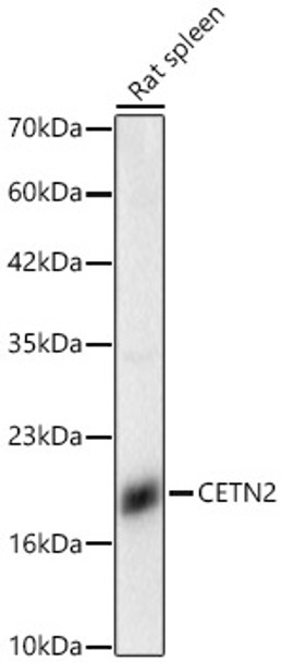 Western blot analysis of Rat spleen, using CETN2 Rabbit pAb (CAB21821) at 1:5000 dilution. Secondary antibody: HRP Goat Anti-Rabbit IgG (H+L) at 1:10000 dilution. Lysates/proteins: 25ug per lane. Blocking buffer: 3% nonfat dry milk in TBST.