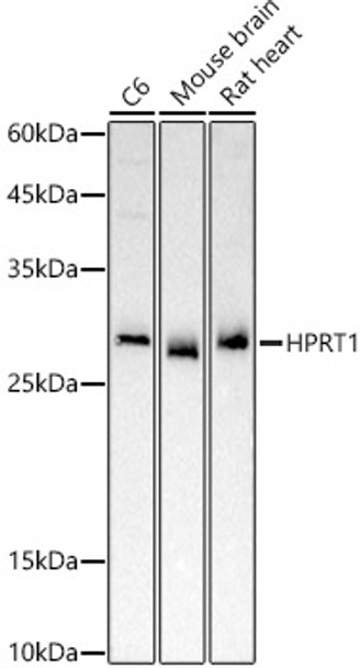 Western blot analysis of extracts of various cell lines, using HPRT1 antibody (CAB21825) at 1:500 dilution. Secondary antibody: HRP Goat Anti-Rabbit IgG (H+L) at 1:10000 dilution. Lysates/proteins: 25μg per lane. Blocking buffer: 3% nonfat dry milk in TBST.