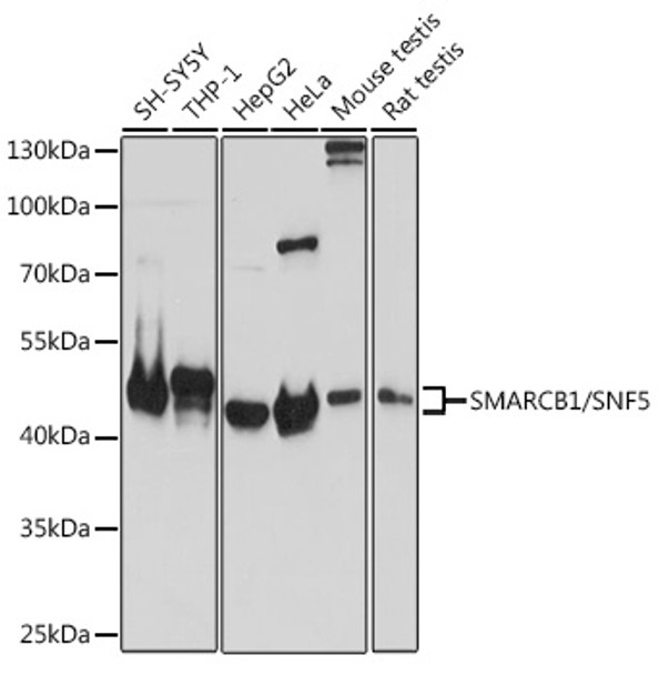 Western blot analysis of extracts of various cell lines, using SMARCB1/SNF5 antibody (CAB21826) at 1:1000 dilution. Secondary antibody: HRP Goat Anti-Rabbit IgG (H+L) at 1:10000 dilution. Lysates/proteins: 25μg per lane. Blocking buffer: 3% nonfat dry milk in TBST.