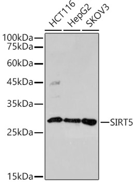 Western blot analysis of extracts of various cell lines, using SIRT5 antibody (CAB21827) at 1:500 dilution. Secondary antibody: HRP Goat Anti-Rabbit IgG (H+L) at 1:10000 dilution. Lysates/proteins: 25μg per lane. Blocking buffer: 3% nonfat dry milk in TBST.