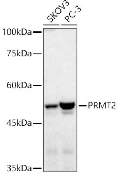 Western blot analysis of extracts of various cell lines, using PRMT2 antibody (CAB21828) at 1:1000 dilution. Secondary antibody: HRP Goat Anti-Rabbit IgG (H+L) at 1:10000 dilution. Lysates/proteins: 25μg per lane. Blocking buffer: 3% nonfat dry milk in TBST.