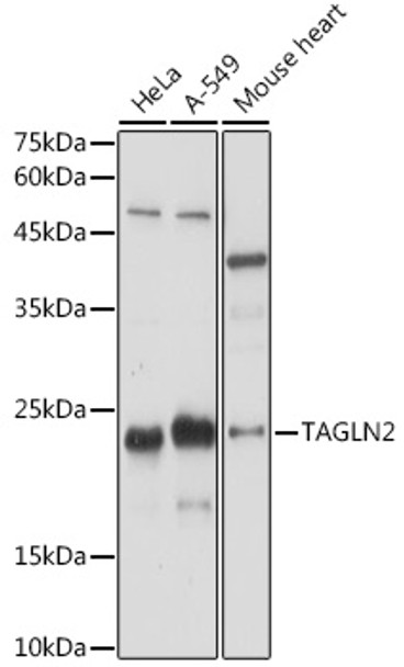 Western blot analysis of extracts of various cell lines, using TAGLN2 antibody (CAB21833) at 1:1000 dilution. Secondary antibody: HRP Goat Anti-Rabbit IgG (H+L) at 1:10000 dilution. Lysates/proteins: 25μg per lane. Blocking buffer: 3% nonfat dry milk in TBST.