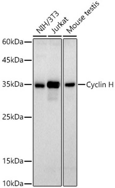 Western blot analysis of extracts of various cell lines, using Cyclin H antibody (CAB21885) at 1:1000 dilution. Secondary antibody: HRP Goat Anti-Rabbit IgG (H+L) at 1:10000 dilution. Lysates/proteins: 25μg per lane. Blocking buffer: 3% nonfat dry milk in TBST.