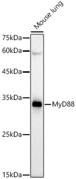 Western blot analysis of extracts of Mouse lung, using MyD88 antibody (CAB21905) at1:2000 dilution. Secondary antibody: HRP Goat Anti-Rabbit IgG (H+L) at1:10000 dilution. Lysates/proteins: 25μg per lane. Blocking buffer: 3% nonfat dry milk in TBST.