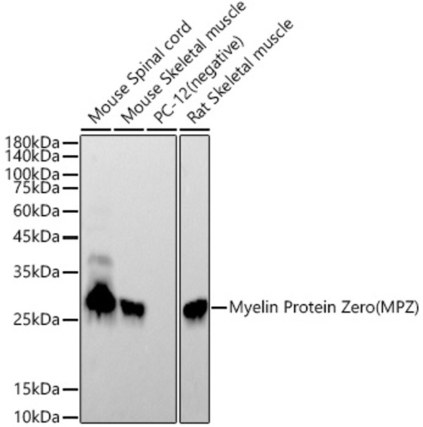 Western blot analysis of extracts of various cell lines, using Myelin Protein Zero (MPZ) antibody ( CAB21931) at1:10000 dilution. Secondary antibody: HRP Goat Anti-Rabbit IgG (H+L) at 1:10000 dilution. Lysates/proteins: 25μg per lane. Blocking buffer: 3% nonfat dry milk in TBST.