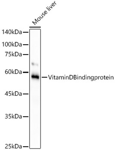 Western blot analysis of mouse liver, using VitaminDBindingprotein antibody (CAB21977) at 1:1000 dilution. Secondary antibody: HRP Goat Anti-Rabbit IgG (H+L) at 1:10000 dilution. Lysates/proteins: 25μg per lane. Blocking buffer: 3% nonfat dry milk in TBST.