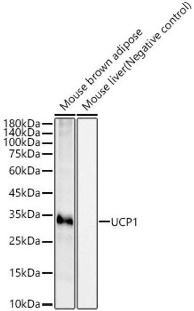 Western blot analysis of various lysates, using UCP1 antibody (CAB21979) at 1:1000 dilution. Secondary antibody: HRP Goat Anti-Rabbit IgG (H+L) at 1:10000 dilution. Lysates/proteins: 25μg per lane. Blocking buffer: 3% nonfat dry milk in TBST.