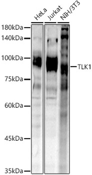 Western blot analysis of extracts of various cell lines, using TLK1 antibody (CAB21987) at 1:1000 dilution. Secondary antibody: HRP Goat Anti-Rabbit IgG (H+L) at 1:10000 dilution. Lysates/proteins: 25μg per lane. Blocking buffer: 3% nonfat dry milk in TBST.