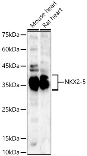 Western blot analysis of various lysates, using NKX2-5 Rabbit pAb (CAB21992) at 1:400 dilution. Secondary antibody: HRP Goat Anti-Rabbit IgG (H+L) at 1:10000 dilution. Lysates/proteins: 25ug per lane. Blocking buffer: 3% nonfat dry milk in TBST.