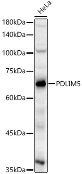 Western blot analysis of HeLa, using PDLIM5 Rabbit pAb (CAB22013) at 1:400 dilution. Secondary antibody: HRP Goat Anti-Rabbit IgG (H+L) at 1:10000 dilution. Lysates/proteins: 25ug per lane. Blocking buffer: 3% nonfat dry milk in TBST.