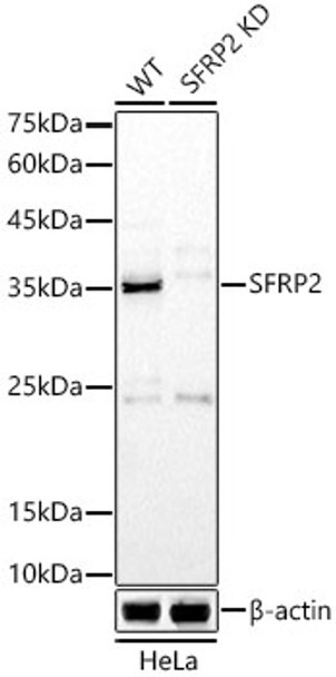 Western blot analysis of extracts from wild type(WT) and SFRP2 knockdown (KD) HeLa cells, using SFRP2 antibody (CAB22017) at 1:1000 dilution. Secondary antibody: HRP Goat Anti-Rabbit IgG (H+L) at 1:10000 dilution. Lysates/proteins: 25μg per lane. Blocking buffer: 3% nonfat dry milk in TBST.