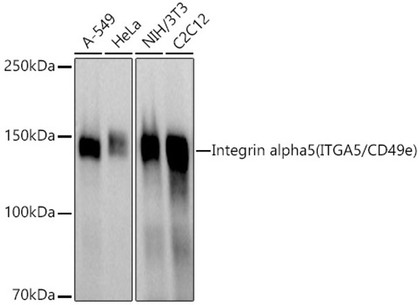 Western blot analysis of extracts of various cell lines, using Integrin alpha 5 (ITGA5/CD49e) antibody (CAB22018) at 1:600 dilution. Secondary antibody: HRP Goat Anti-Rabbit IgG (H+L) at 1:10000 dilution. Lysates/proteins: 25μg per lane. Blocking buffer: 3% nonfat dry milk in TBST.