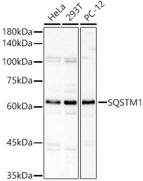 Western blot analysis of various lysates, using SQSTM1 Rabbit pAb (CAB22025) at 1:600 dilution. Secondary antibody: HRP Goat Anti-Rabbit IgG (H+L) at 1:10000 dilution. Lysates/proteins: 25ug per lane. Blocking buffer: 3% nonfat dry milk in TBST.