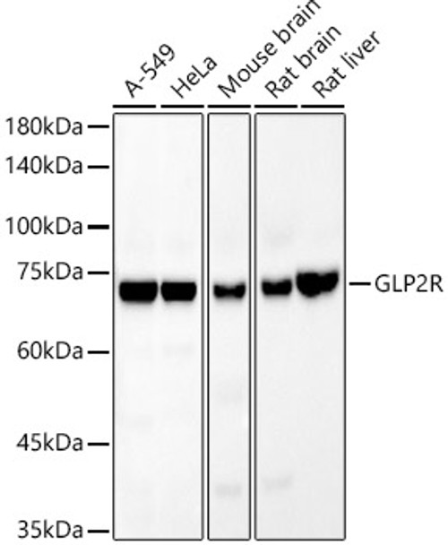 Western blot analysis of extracts of various cell lines, using GLP2R Rabbit mAb (CAB22049) at1:20000 dilution. Secondary antibody: HRP Goat Anti-Rabbit IgG (H+L) at 1:10000 dilution. Lysates/proteins: 25μg per lane. Blocking buffer: 3% nonfat dry milk in TBST.