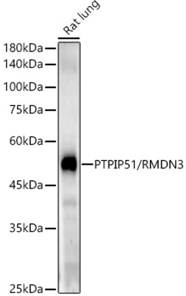Western blot analysis of extracts of various cell lines, using PTPIP51/RMDN3 antibody (CAB22057) at1:2000 dilution. Secondary antibody: HRP Goat Anti-Rabbit IgG (H+L) at 1:10000 dilution. Lysates/proteins: 25μg per lane. Blocking buffer: 3% nonfat dry milk in TBST.