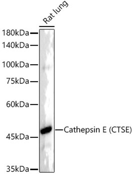 Western blot analysis of extracts from rat lung, using Cathepsin E (CTSE) antibody (CAB22092) at1:2000 dilution. Secondary antibody: HRP Goat Anti-Rabbit IgG (H+L) at 1:10000 dilution. Lysates/proteins: 25ug per lane. Blocking buffer: 3% nonfat dry milk in TBST.