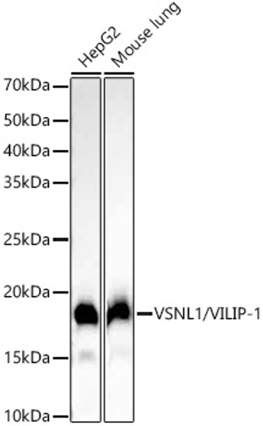 Western blot analysis of extracts of various cell lines, using VSNL1/VILIP-1 antibody (CAB22100) at1:2000 dilution. Secondary antibody: HRP Goat Anti-Rabbit IgG (H+L) at 1:10000 dilution. Lysates/proteins: 25μg per lane. Blocking buffer: 3% nonfat dry milk in TBST.
