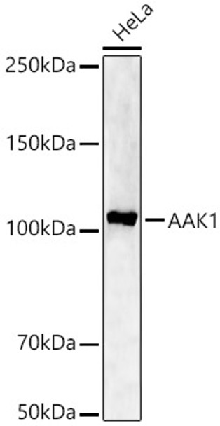 Western blot analysis of HeLa, using AAK1 Rabbit pAb (CAB22105) at 1:1000 dilution. Secondary antibody: HRP Goat Anti-Rabbit IgG (H+L) at 1:10000 dilution. Lysates/proteins: 25ug per lane. Blocking buffer: 3% nonfat dry milk in TBST.